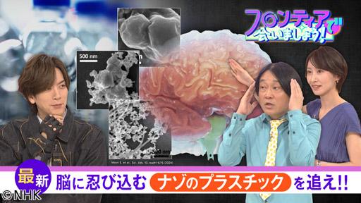 フロンティアで会いましょう！（２３）脳に忍び込むナゾのプラスチックを追え！！🈖🈑
