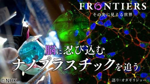 フロンティア　脳に忍び込むナノプラスチックを追う🈖🈑