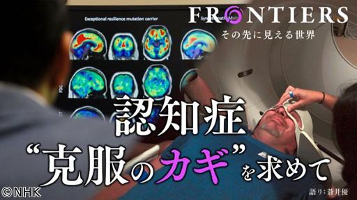 フロンティア　認知症“克服のカギ”を求めて🈖🈑